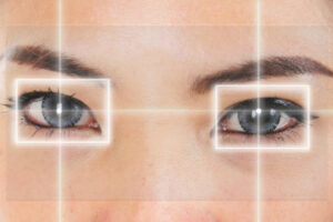 Eye Laser