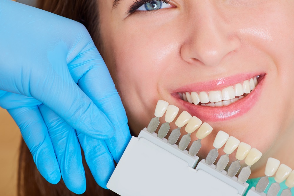 денталь отбеливание зубов