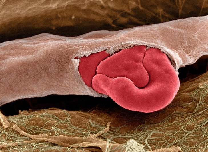 Поврежденный капилляр с красными кровяными тельцами под электронным микроскопом