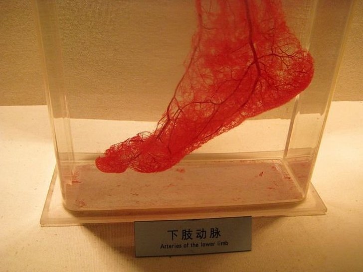 Густая паутина артерий в ноге человека