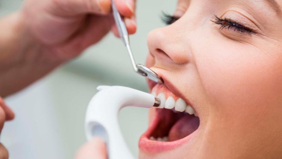 чищення зубів ультразвуком