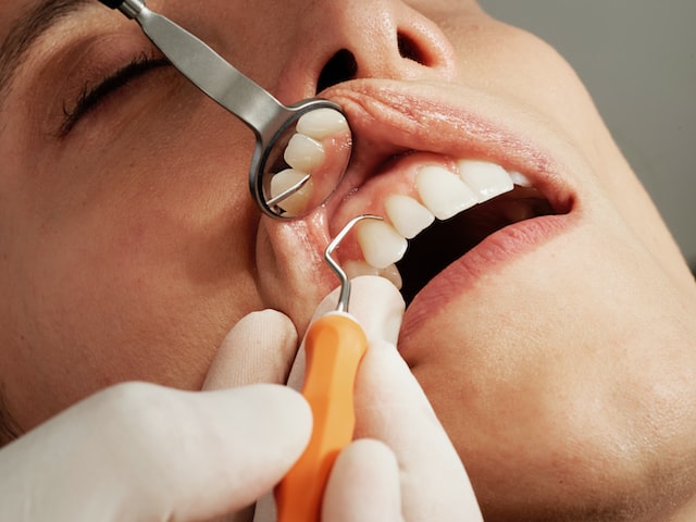 как реставрируют зубы
