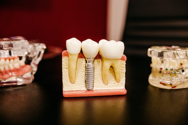 способы реставрации зубов